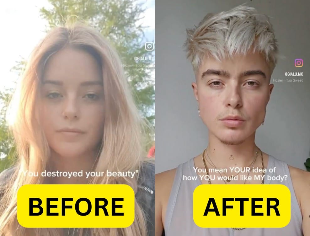 Conservatives Claim Leftism DESTROYS The Mind with Trans Man Before After Comparison